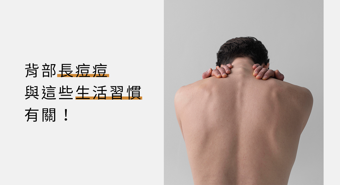 背部長痘痘與這些生活習慣有關！
