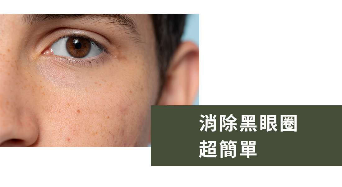 熊貓眼說再見！超簡單的方法幫你消除黑眼圈