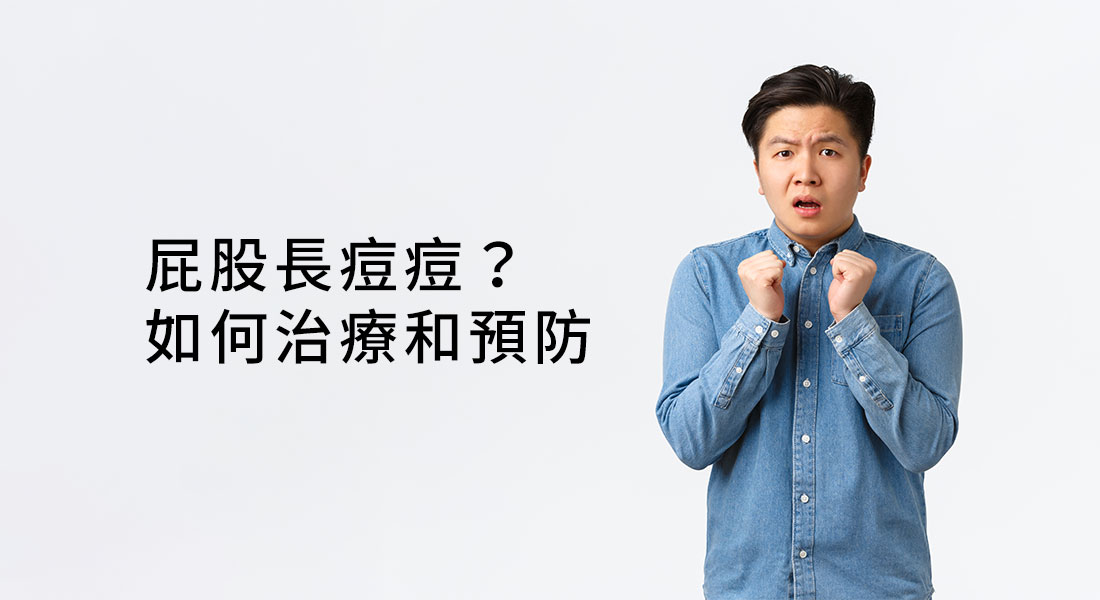 屁股長痘痘？如何治療和預防