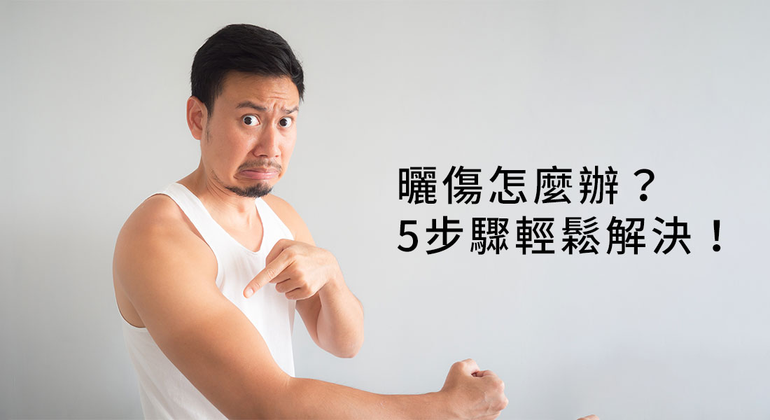 曬傷怎麼辦？5個關鍵步驟讓你輕鬆解決！
