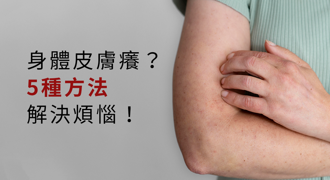 身體莫名發癢怎麼辦？5種方法幫你解決煩惱！