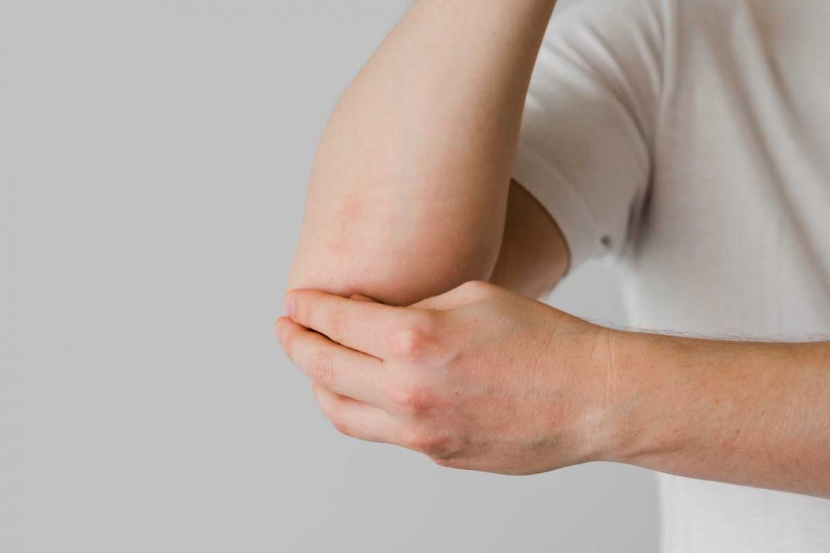 手肘長痘痘的困擾：原因、科別和解決方法！