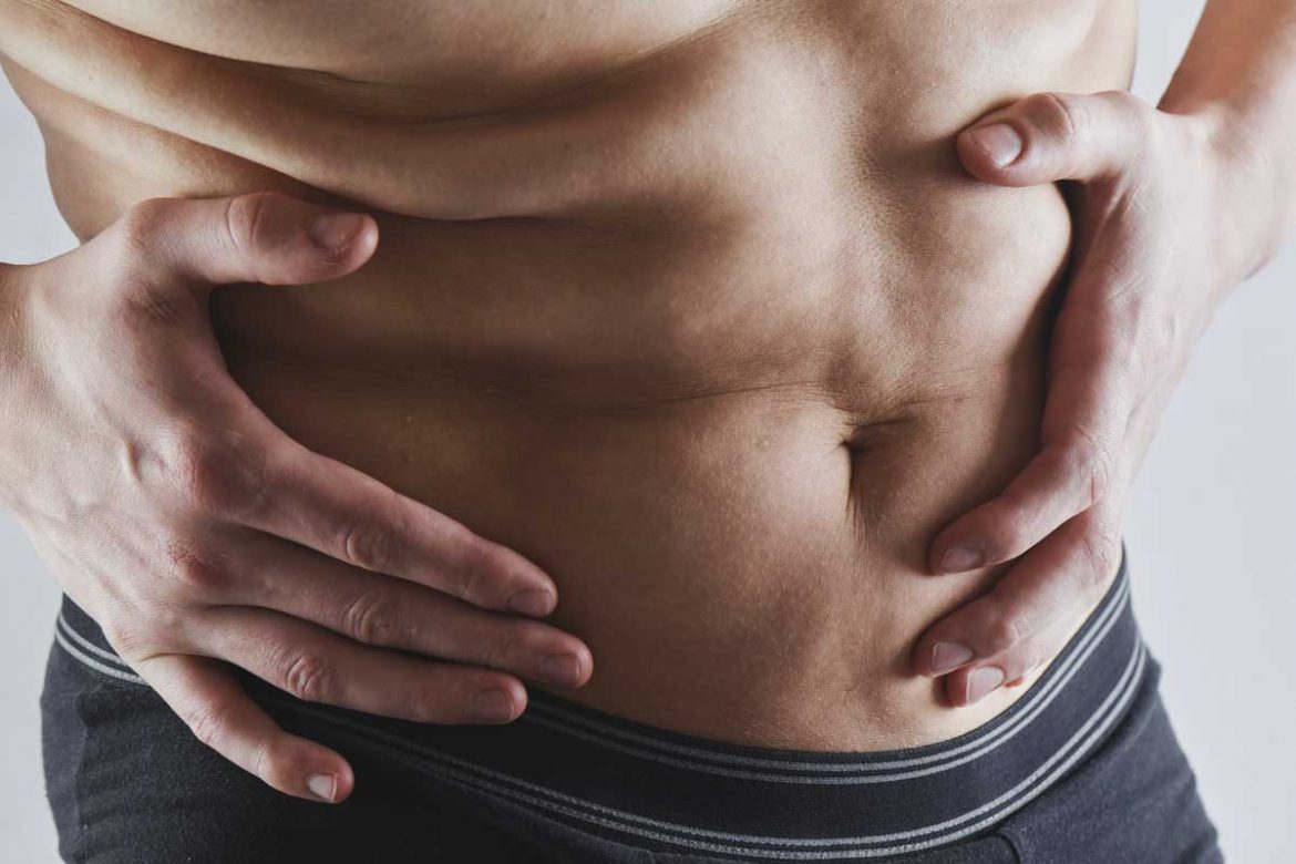 生長紋會消失嗎？揭開真相，告訴你如何消除生長紋！