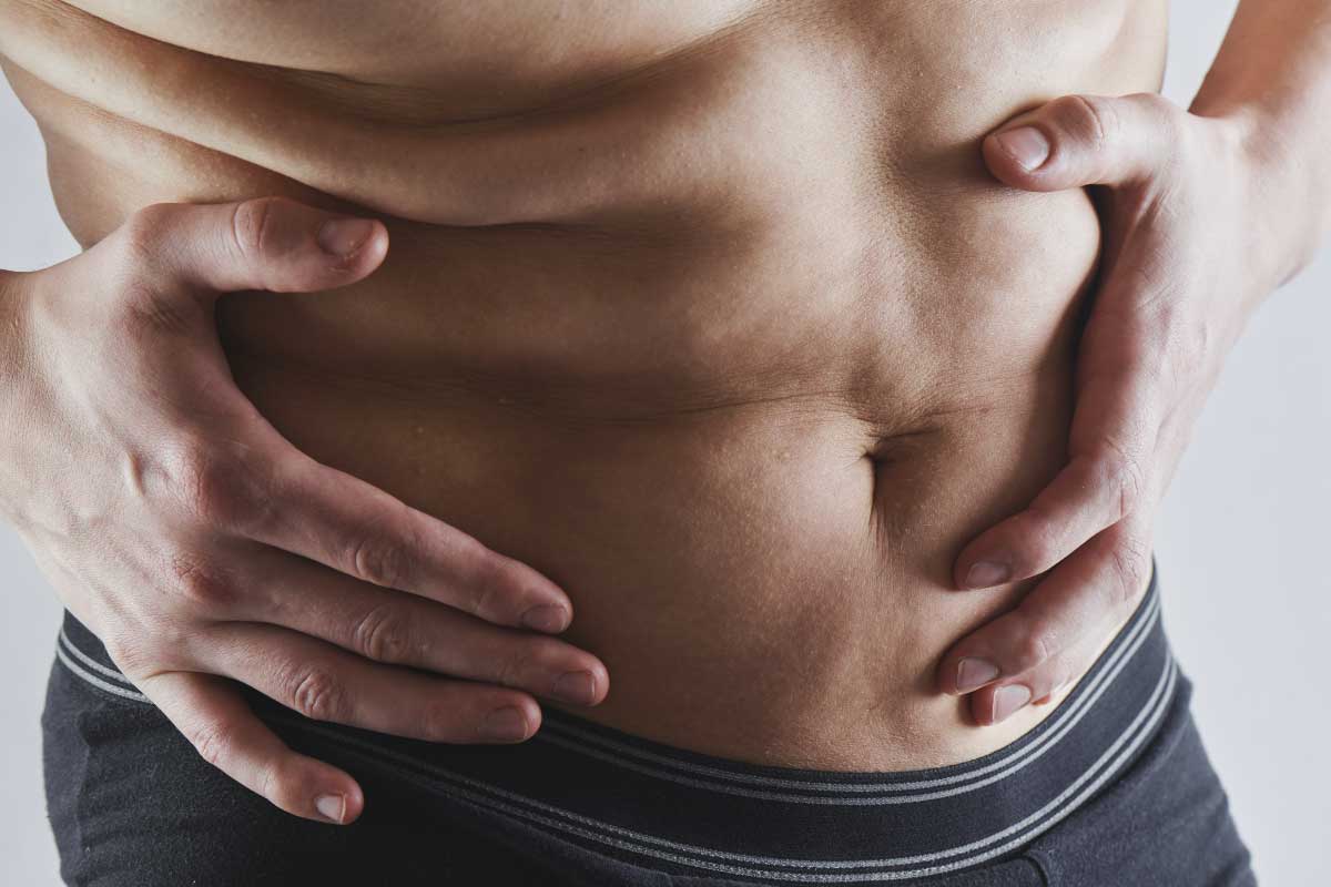 生長紋會消失嗎