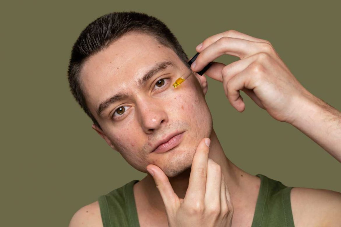 徹底解決痘痘肌困擾！痘痘肌保養順序與推薦品！