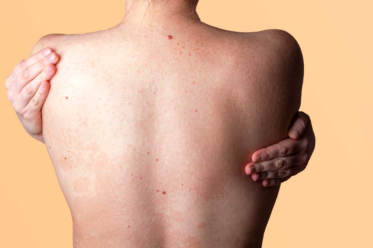 皮膚一顆一顆紅紅的不會癢