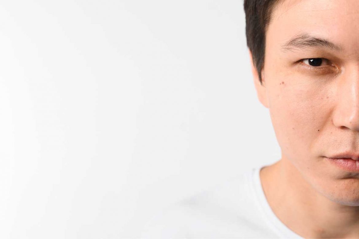 眉心長痘痘怎麼消？8個方法幫你擺脫煩惱！