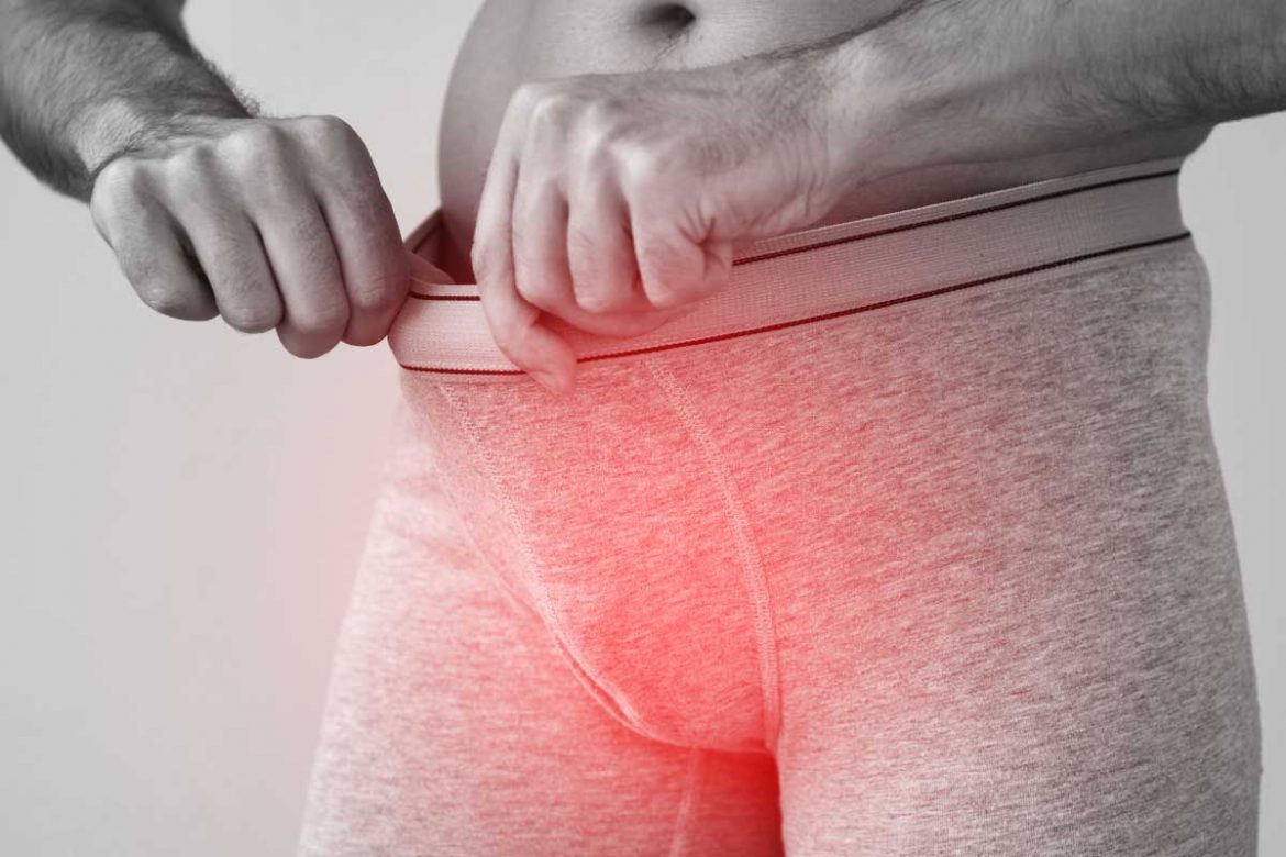 私密處毛囊炎硬塊揭密：深入解析成因、驚艷治療與預防策略！