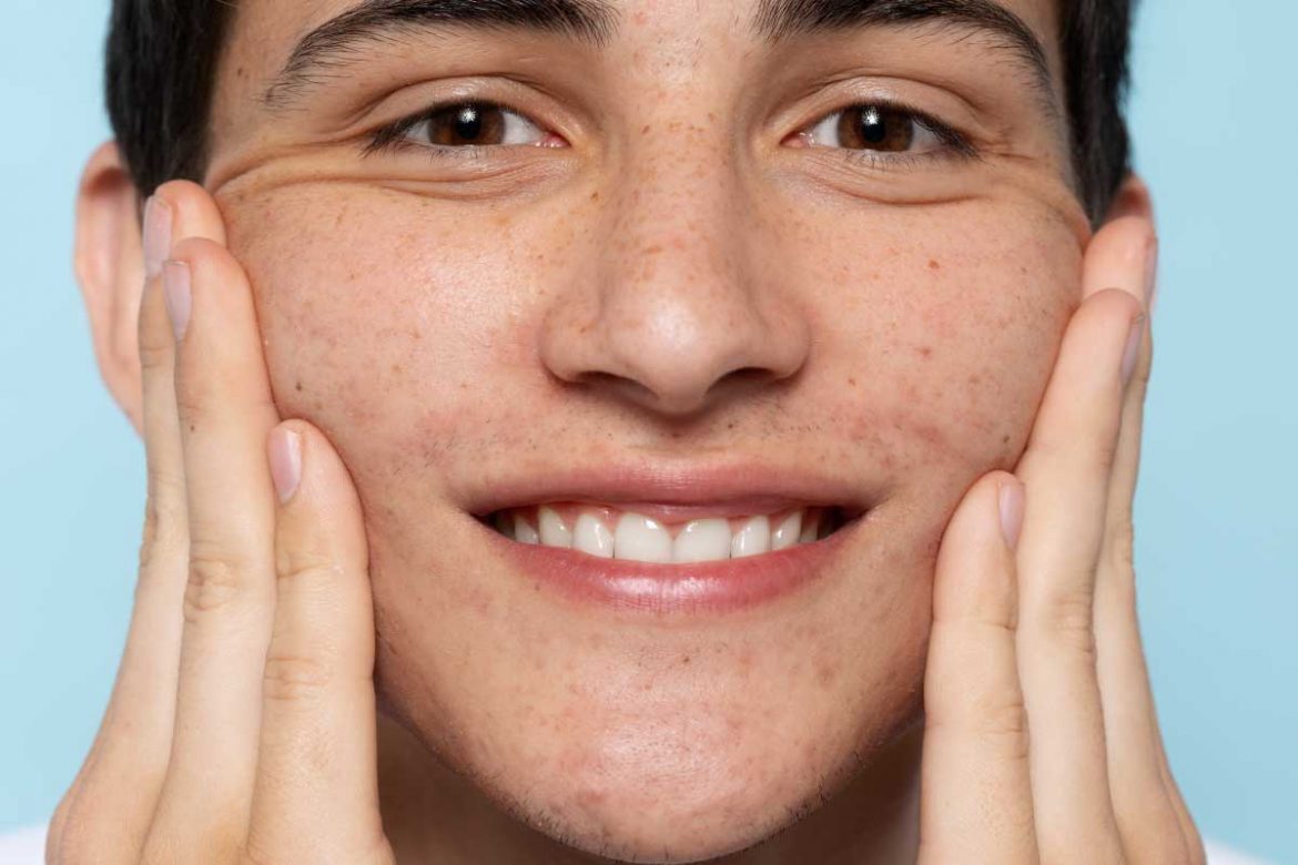 毛孔無煩惱！8個方法縮小毛孔，重現細緻肌膚！