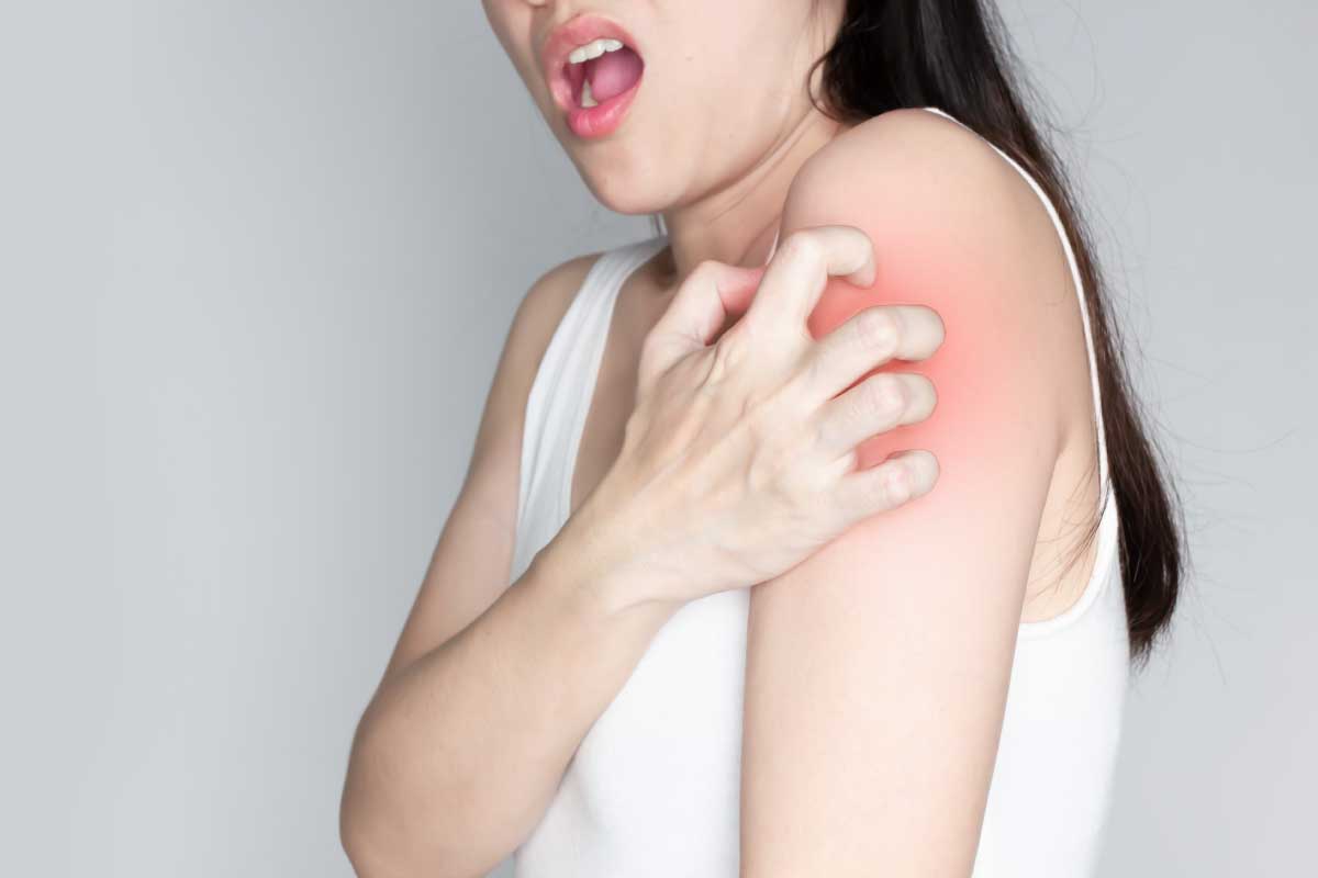 身體莫名發癢怎麼辦