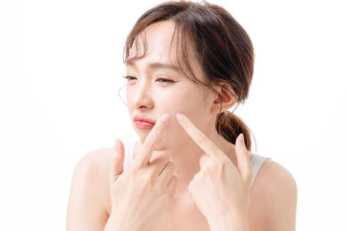 長痘痘吃什麼保健食品