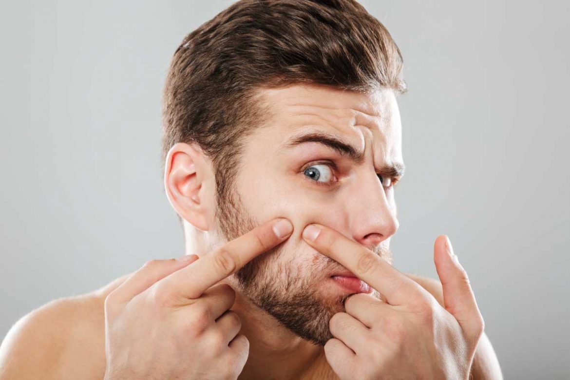 內分泌失調痘痘看哪科？找對科別，迎接健康肌膚！