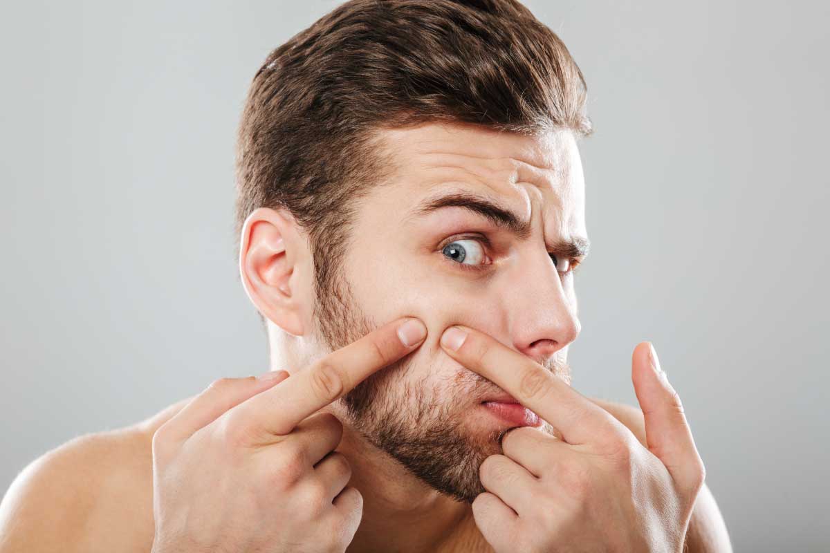 內分泌失調痘痘看哪科